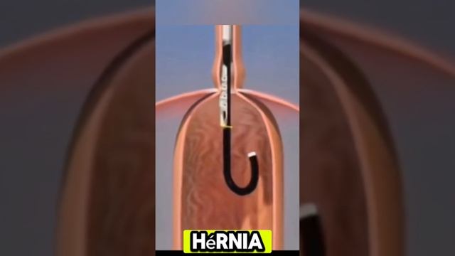 Tratamento gastroesofágico