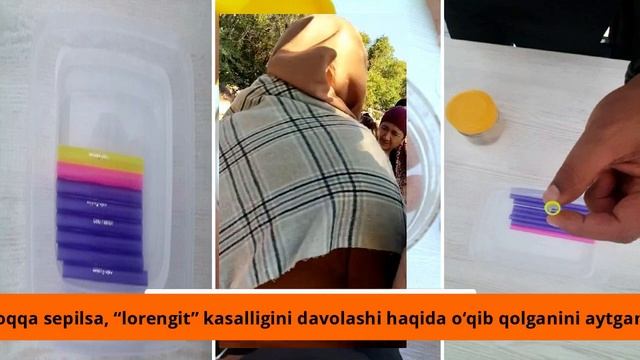 Одамларни тупуриб даволайдиган табиб аслида ким