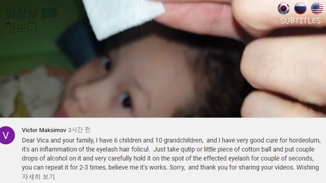 [구독자 댓글] 미국에서 눈 다래끼 소독하는 팁을 보내주었어요 :) / 자막 CC