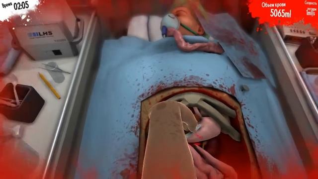 Surgeon Simulator 2013 Мистер скальпель спасёт ваши почки !