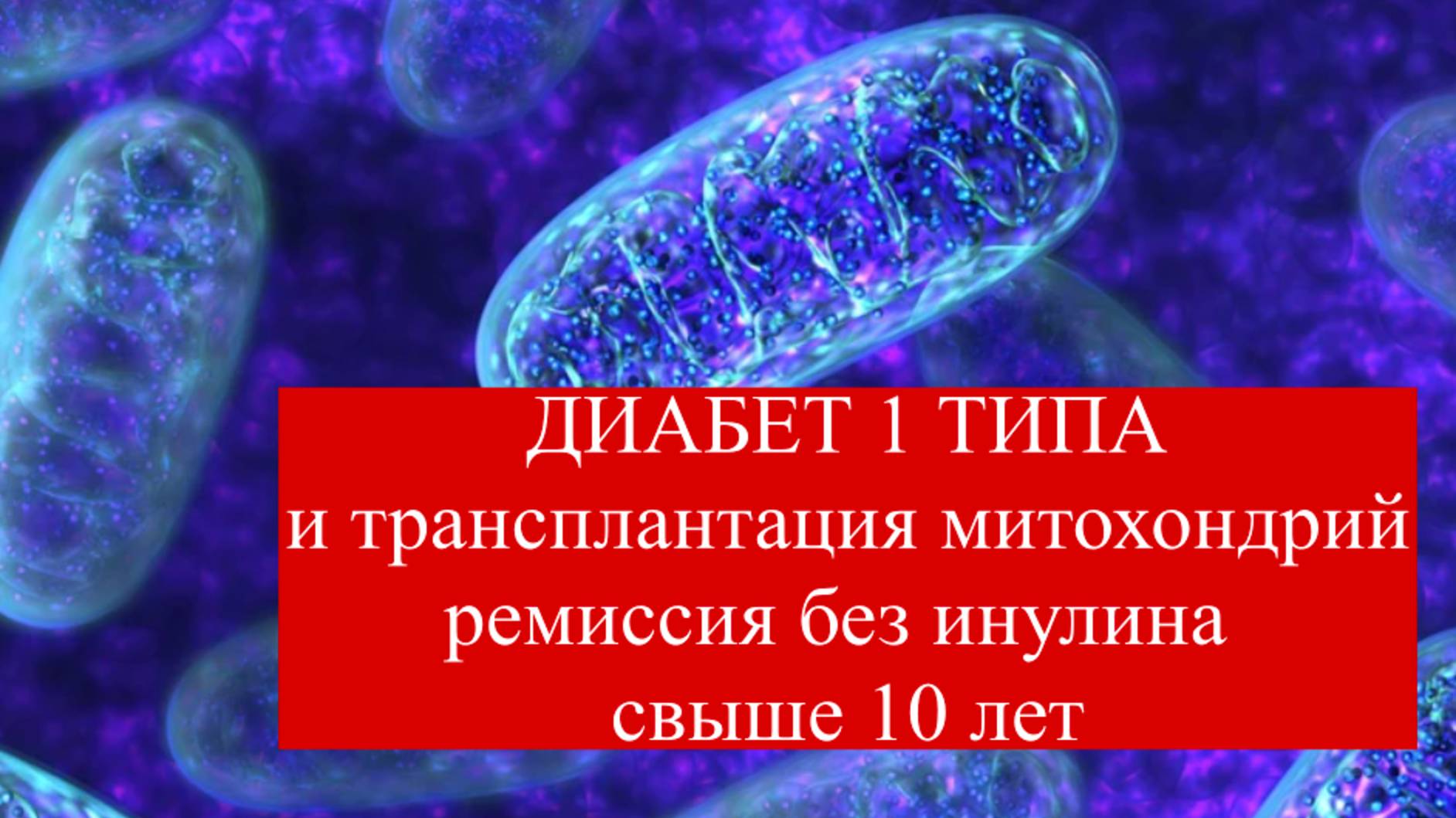 Трансплантация митохондрий, диабет 1 типа. Без инсулина более 10 лет. #лечениедиабета