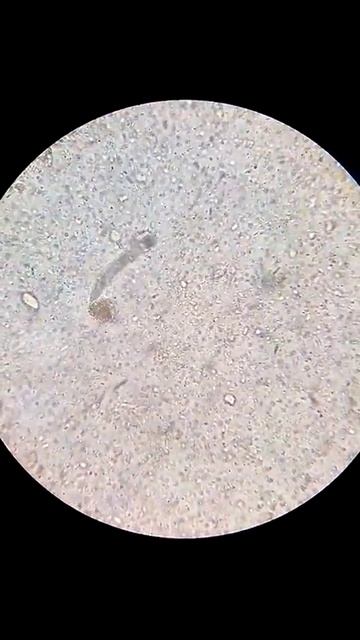 parasito ancylostoma