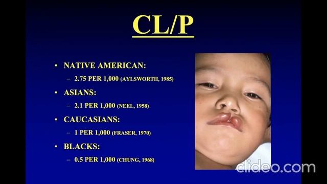 Oral & Maxillofacial Surgery Review 2024 - 93. Cleft Lip & Palate Deformities - Part 1