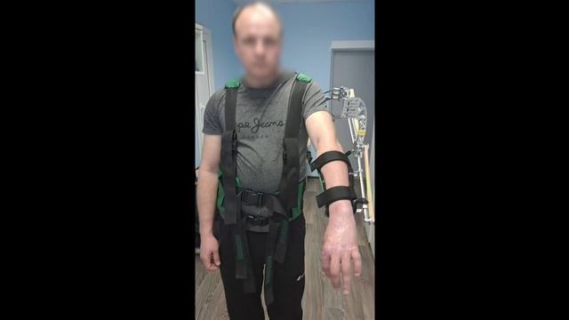 Состояние после тяжелой ЧМТ с ушибом мозга, спастический гемипарез