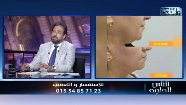 الناس الحلوة | ما هو الميزوبوتكس ودوره فى تجميل ونضارة البشرة مع دكتور كريم الجارحي