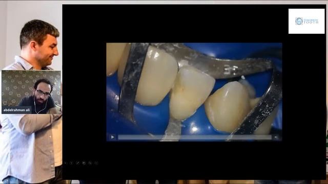 anterior direct esthetic