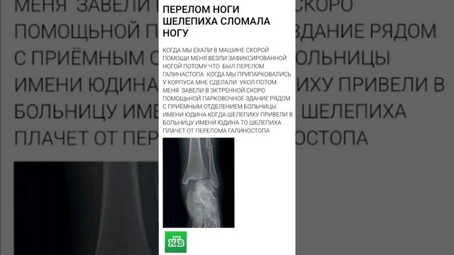 Selerkna Я НЕ МОГУ ВЫКИНУТЬ ТЕБЯ ИЗ ГОЛОВЫ