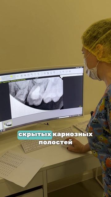 Как проводится рентген зубов?