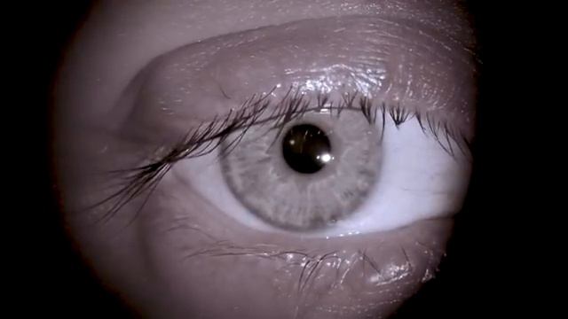 Ячмень. Что делать, как вылечить. Центр Ока