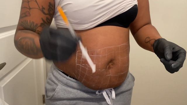 2nd Round Of Lipo Shots|Update on My Results|Dr Lipo Injections