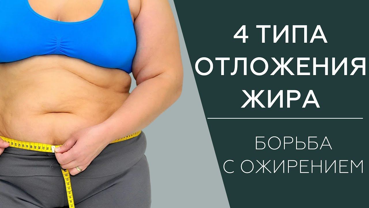 Типы ожирения | Как бороться с жиром | Стратегия для массажистов