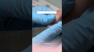 Поднимаем клюющие ногти за 30 секунд