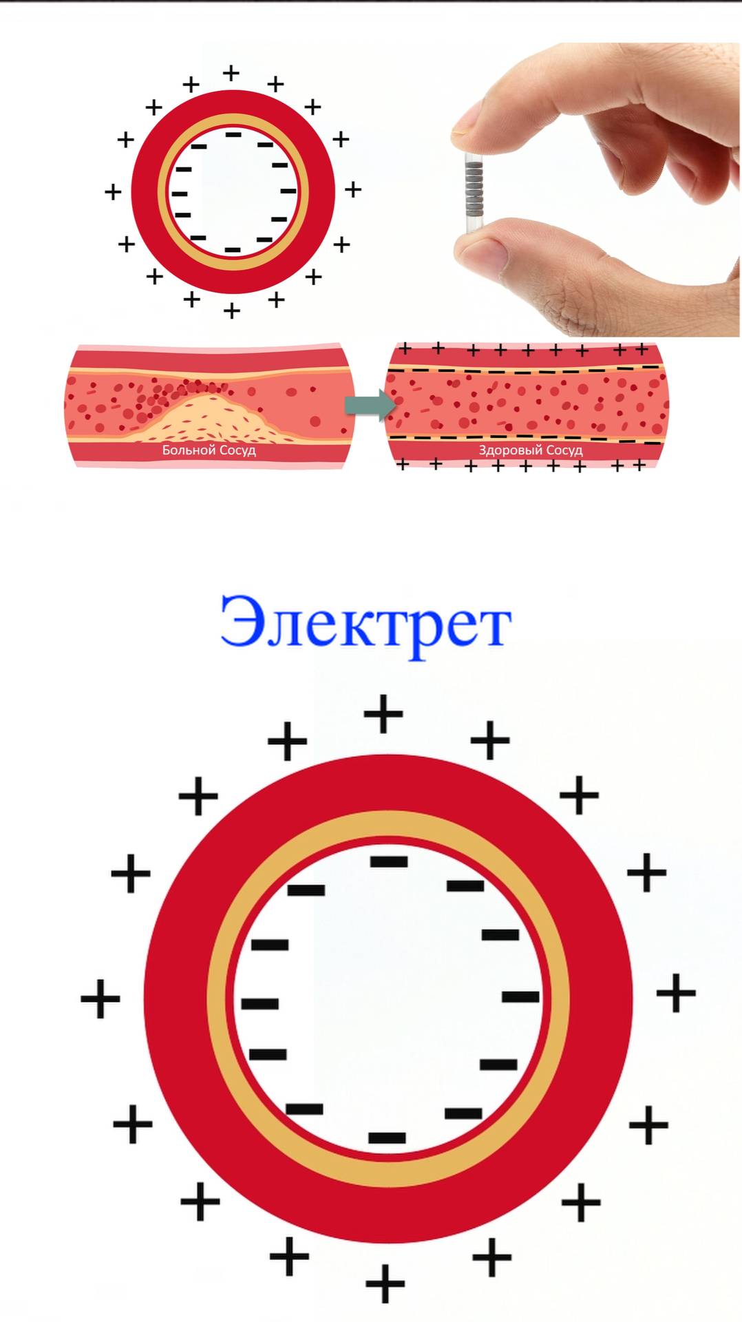 4_Электреты
