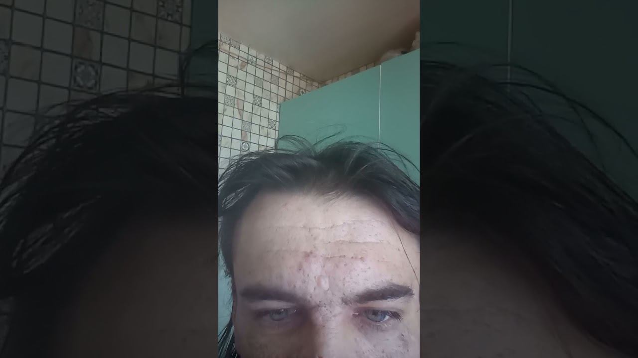 my eyes
