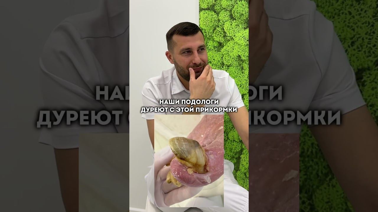 Мы в тренде  #подолог #подологмосква