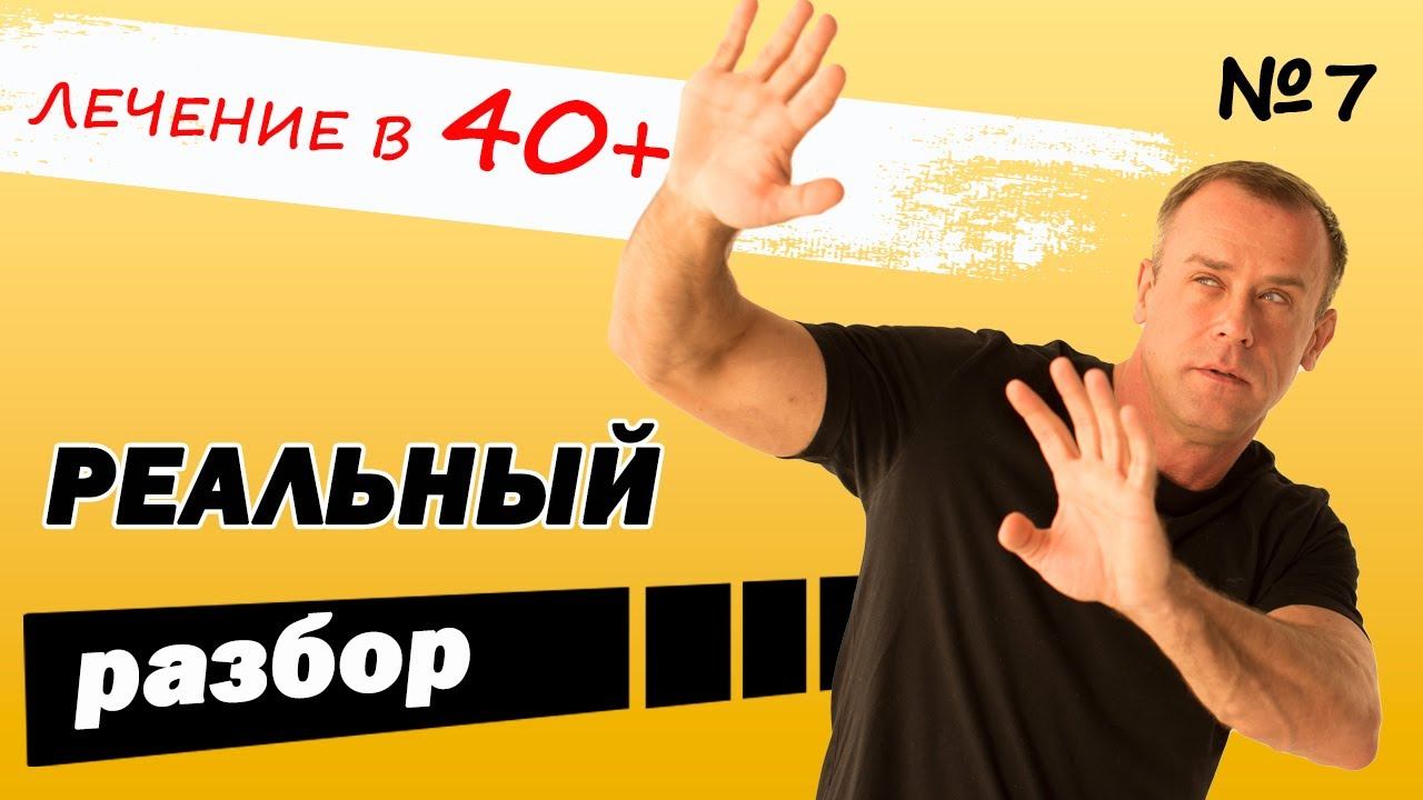 Элайнеры в 40 лет! Как вам результат?