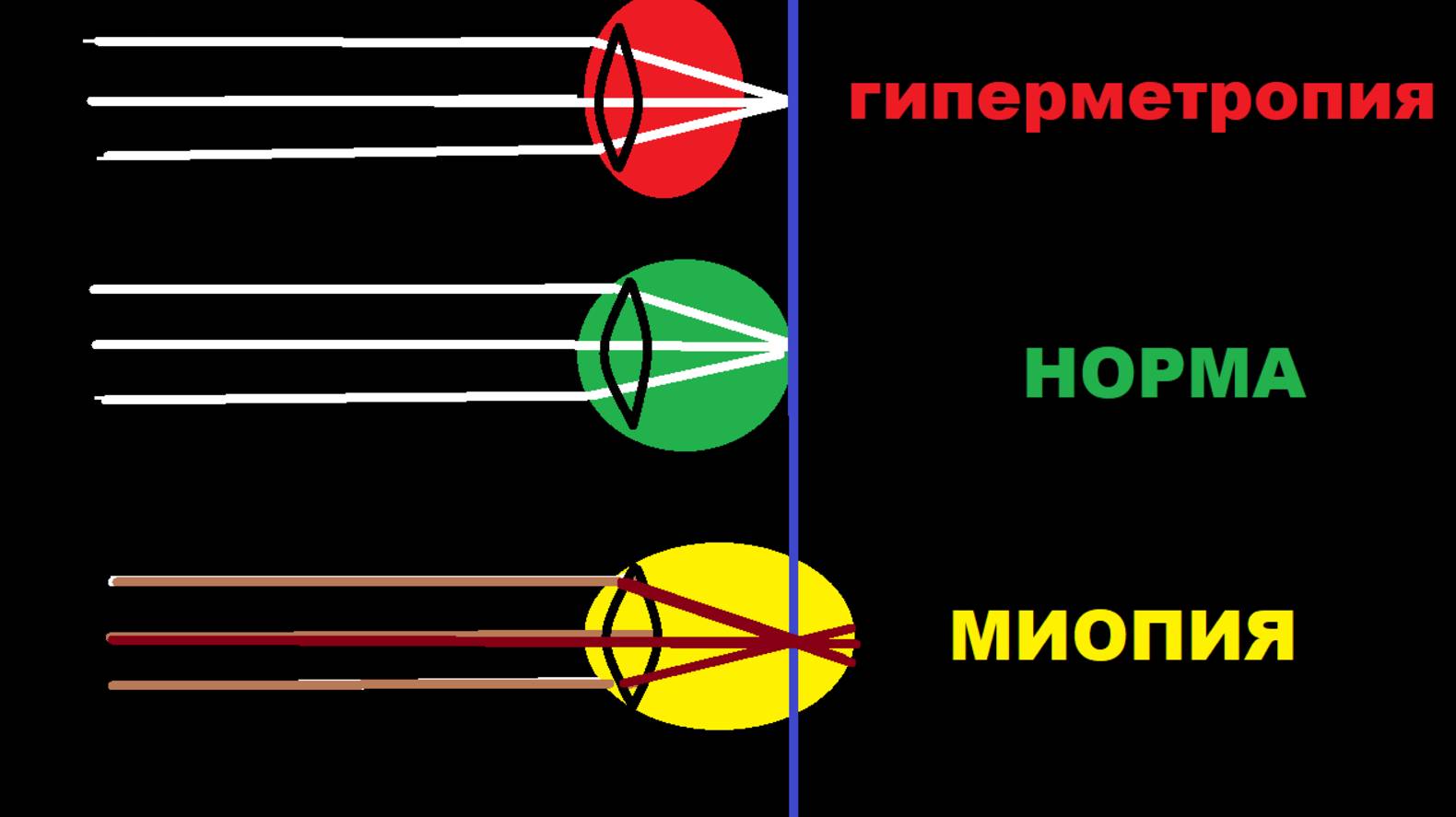 Побуждение к ясному видению! Полное дыхание. Господи помилуй - ЗРЕНИЕ СПАСТИ!