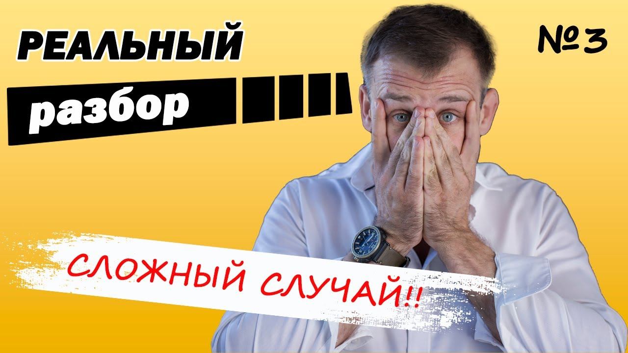Очень сложный случай! Как исправить зубы?