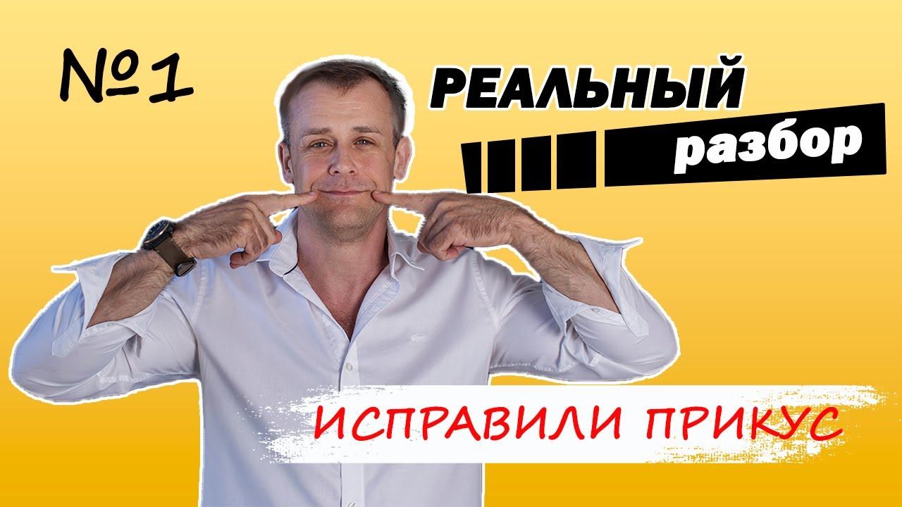 Уютная ортодонтия. Как мы исправили этот прикус?