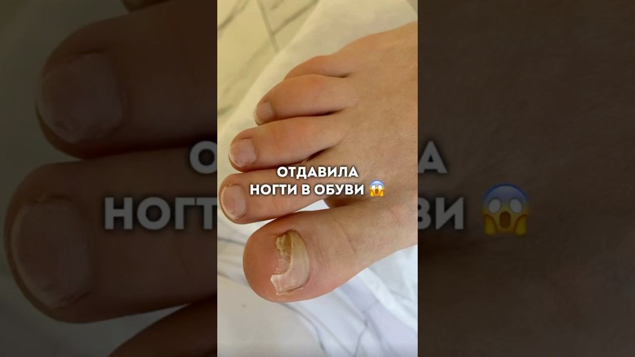 И такое бывает… #подолог #подологмосква