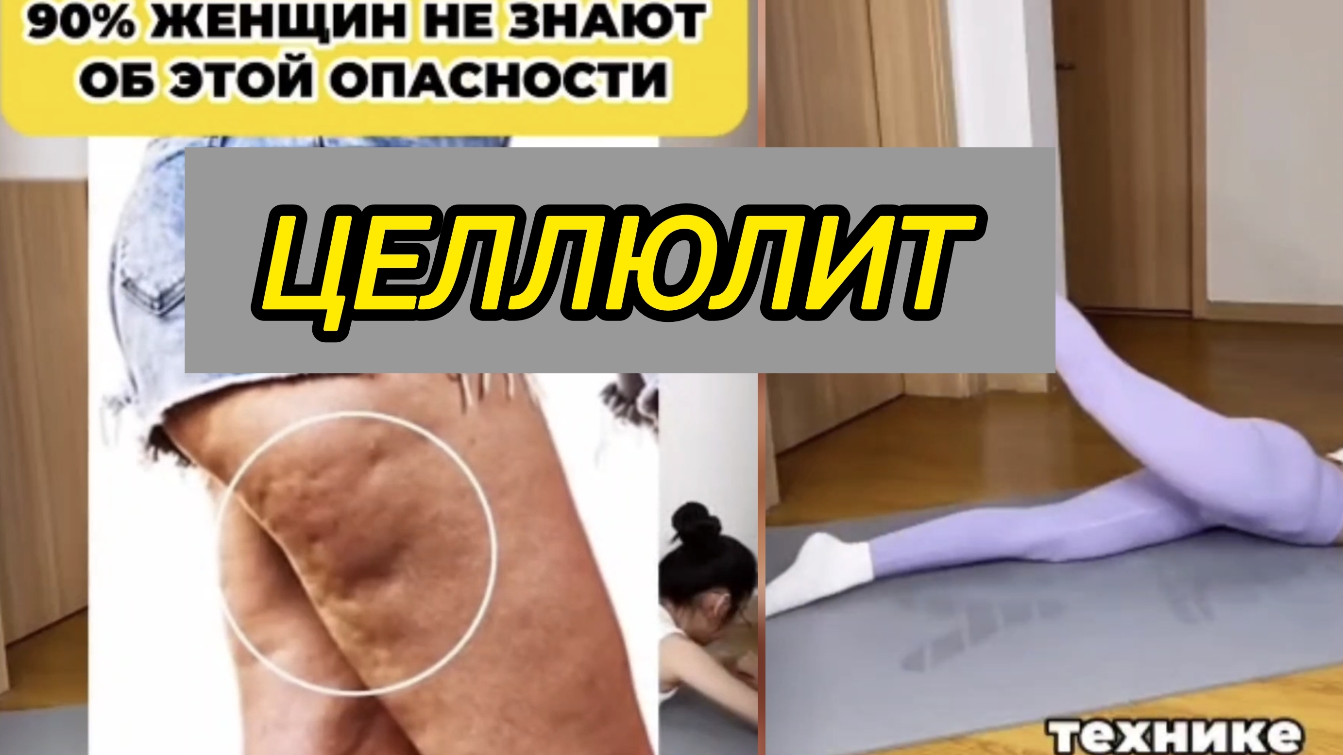 Целлюлит -это не просто красота Женщины не знают об этом #целлюлит #здоровье #похудение