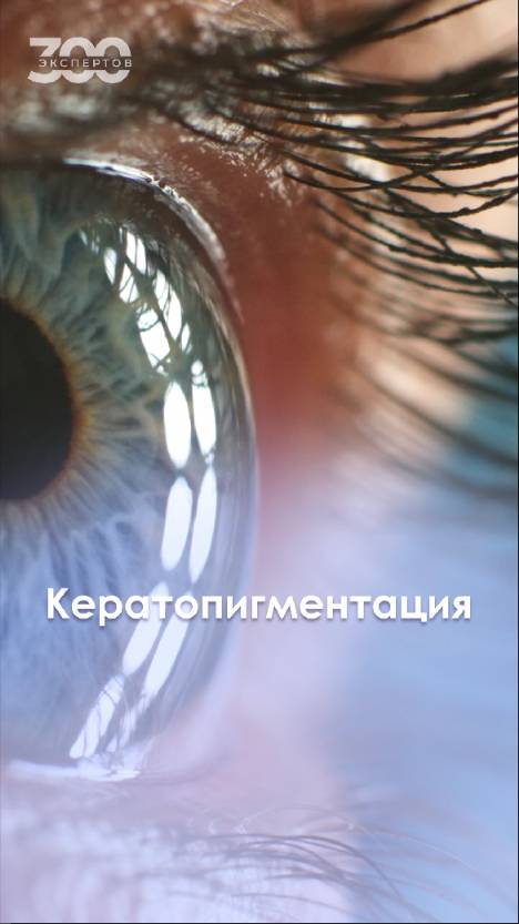 Как поменять цвет своих глаз навсегда? Кератопигментация!