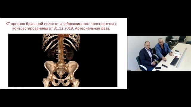 Капто А.А. Дифференциальная диагностика юкставезикального уретеролити. 21.09.2023.