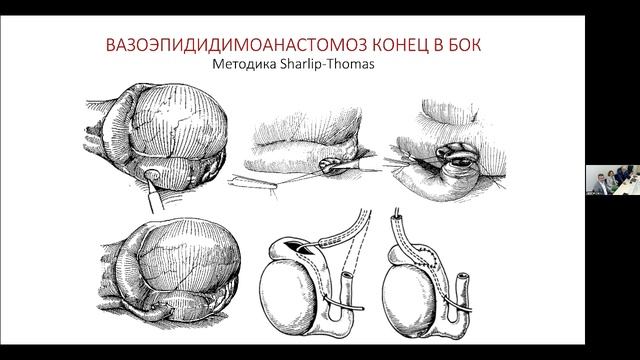 Капто А.А., Особенности ведения пациентов с тяжелыми формами нарушения сперматогенеза. 08.06.2023.