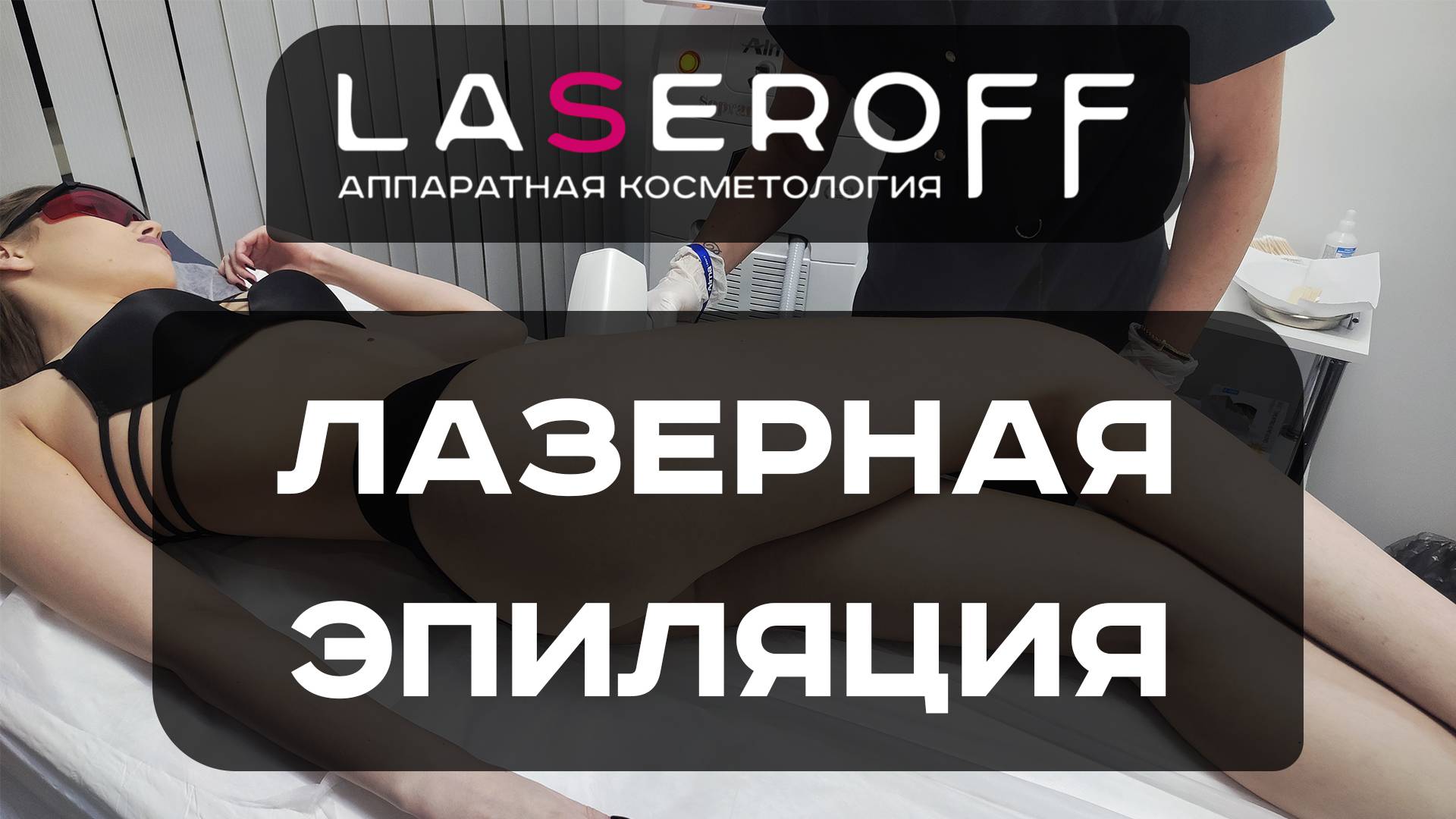 Лазерная эпиляция