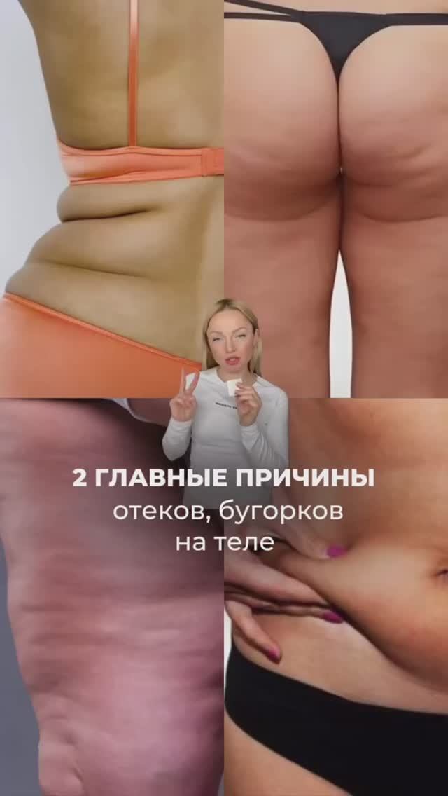 2 ГЛАВНЫЕ ПРИЧИНЫ отеков, бугорков на теле