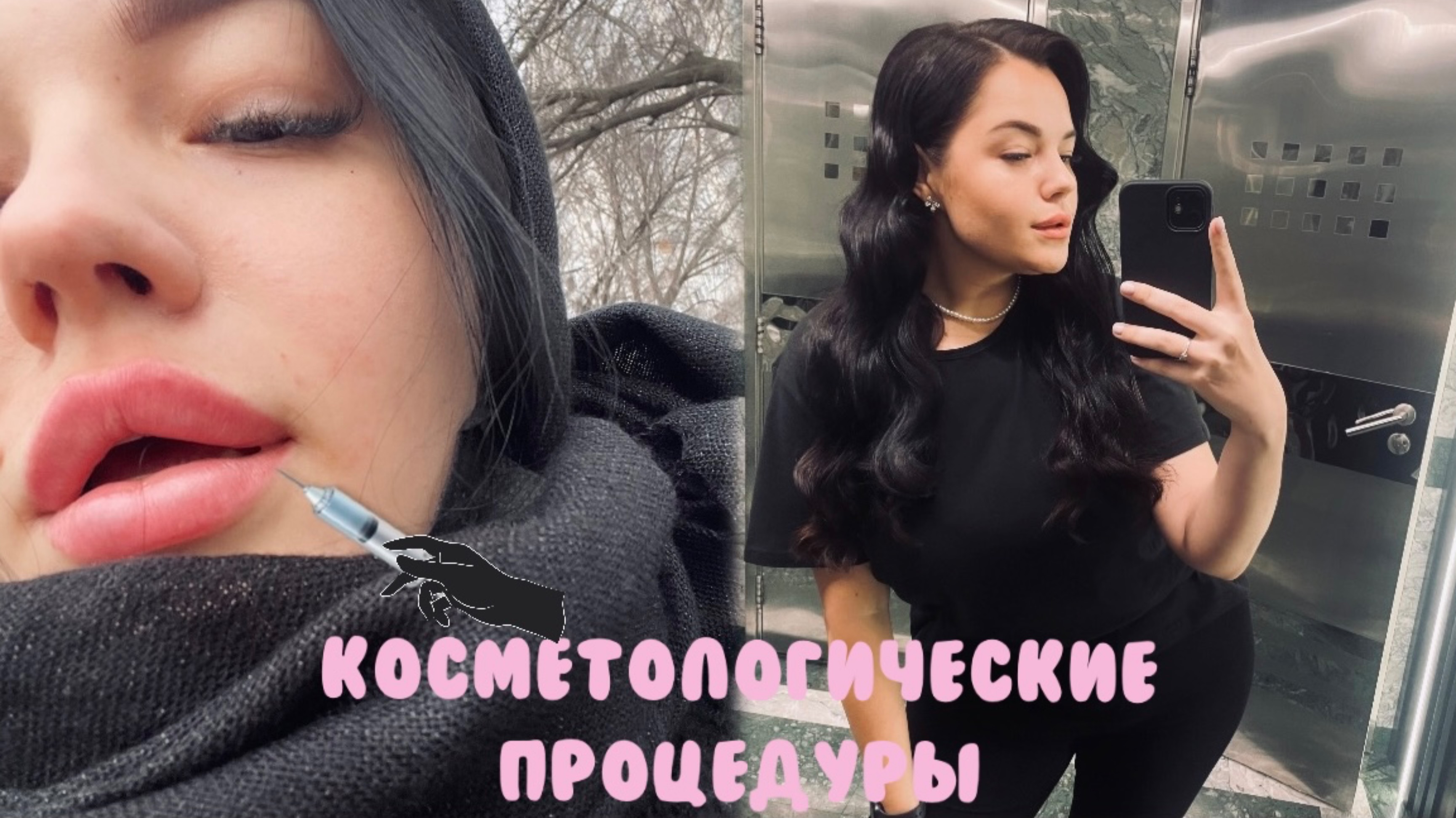 ЧТО ПРОИЗОШЛО В САЛОНЕ КРАСОТЫ🇲🇩?! увеличение губ 🫦как выбрать косметолога 🧑🏻⚕️?!