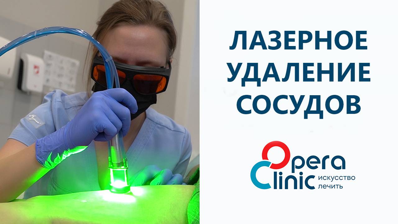 Лазерное удаление сосудов