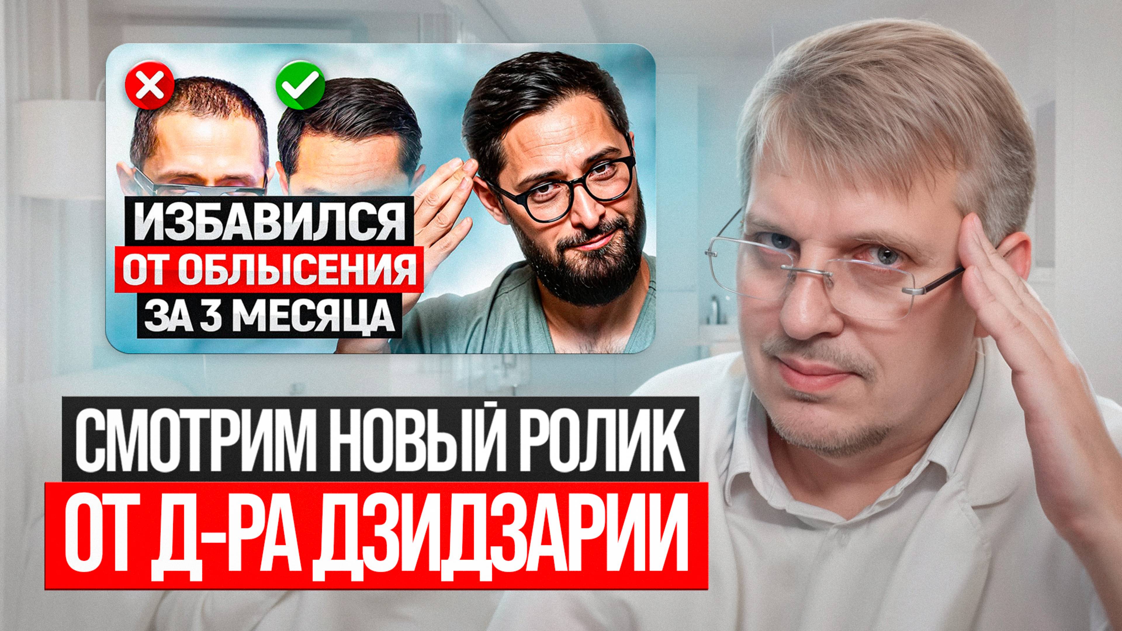 Смотрим новый ролик от д-ра Дзидзарии о выпадении волос