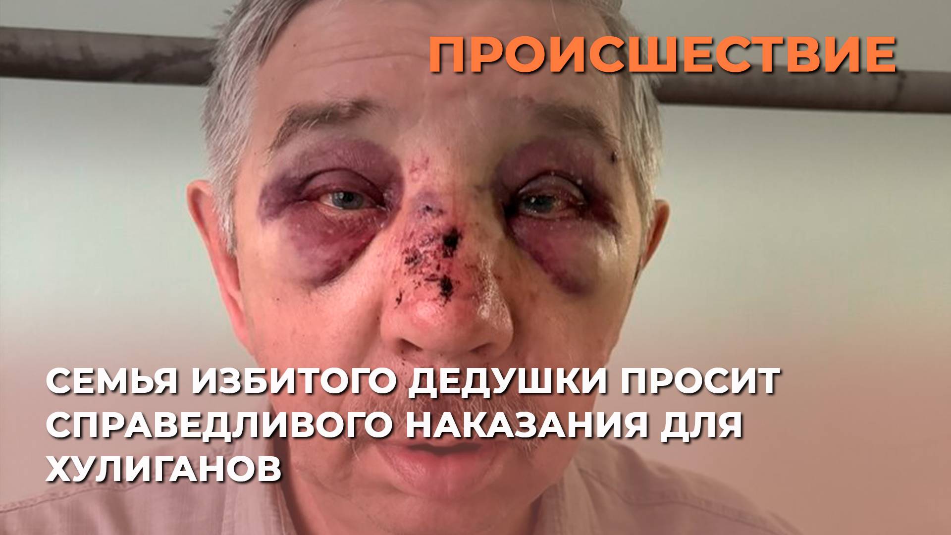 Семья избитого дедушки просит справедливого наказания для хулиганов