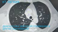 Новая компьютерная томография в станице Ленинградской, Краснодарский край