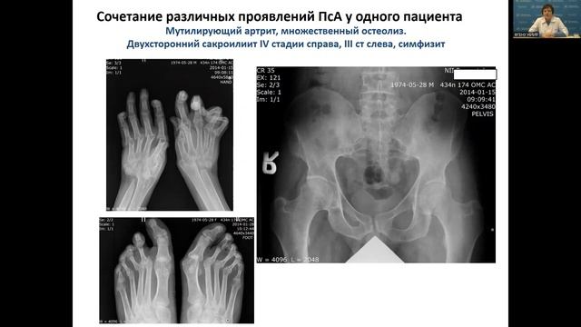 ПсА Корсакова Ю Л от 30 01 2023