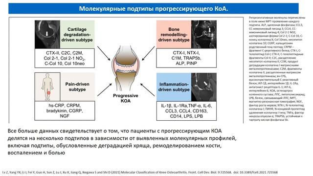 B050 Остеоартрит_ патогенез, диагностика, клиника, фенотипы, тактика ведения больных.