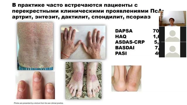 ГИБП при ПсА Коротаева Т.В.