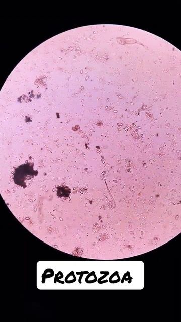 It is the most common parasite present in the urine and the cause of a disease called trichomoniasi