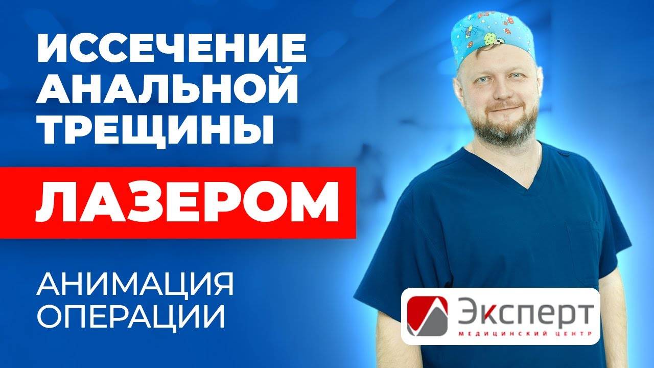 Иссечение анальной трещины лазером