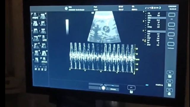 Мое ❤️.mp4