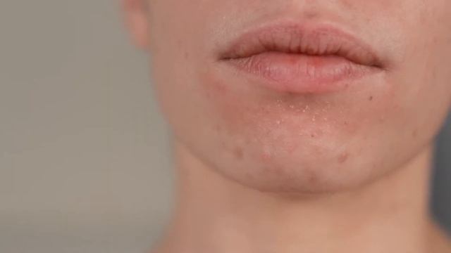 ProactivMD || Update #4- Done with Week 3