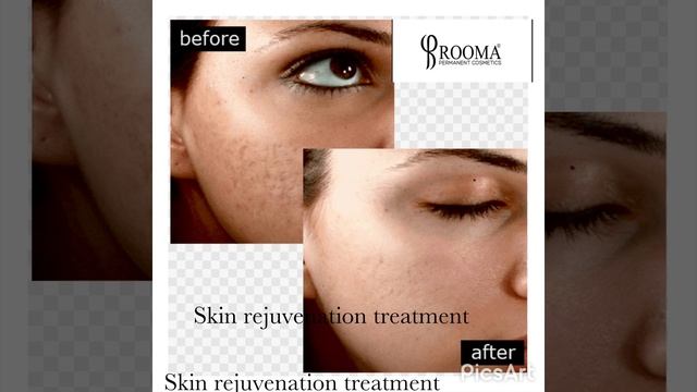 Skin treatments at Rooma