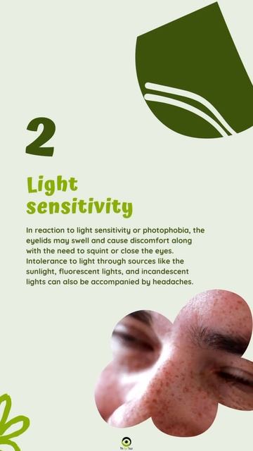 Common Symptoms Of Swollen Eyelids
