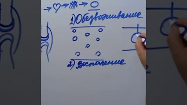 О суставах.
Основные причины разрушения