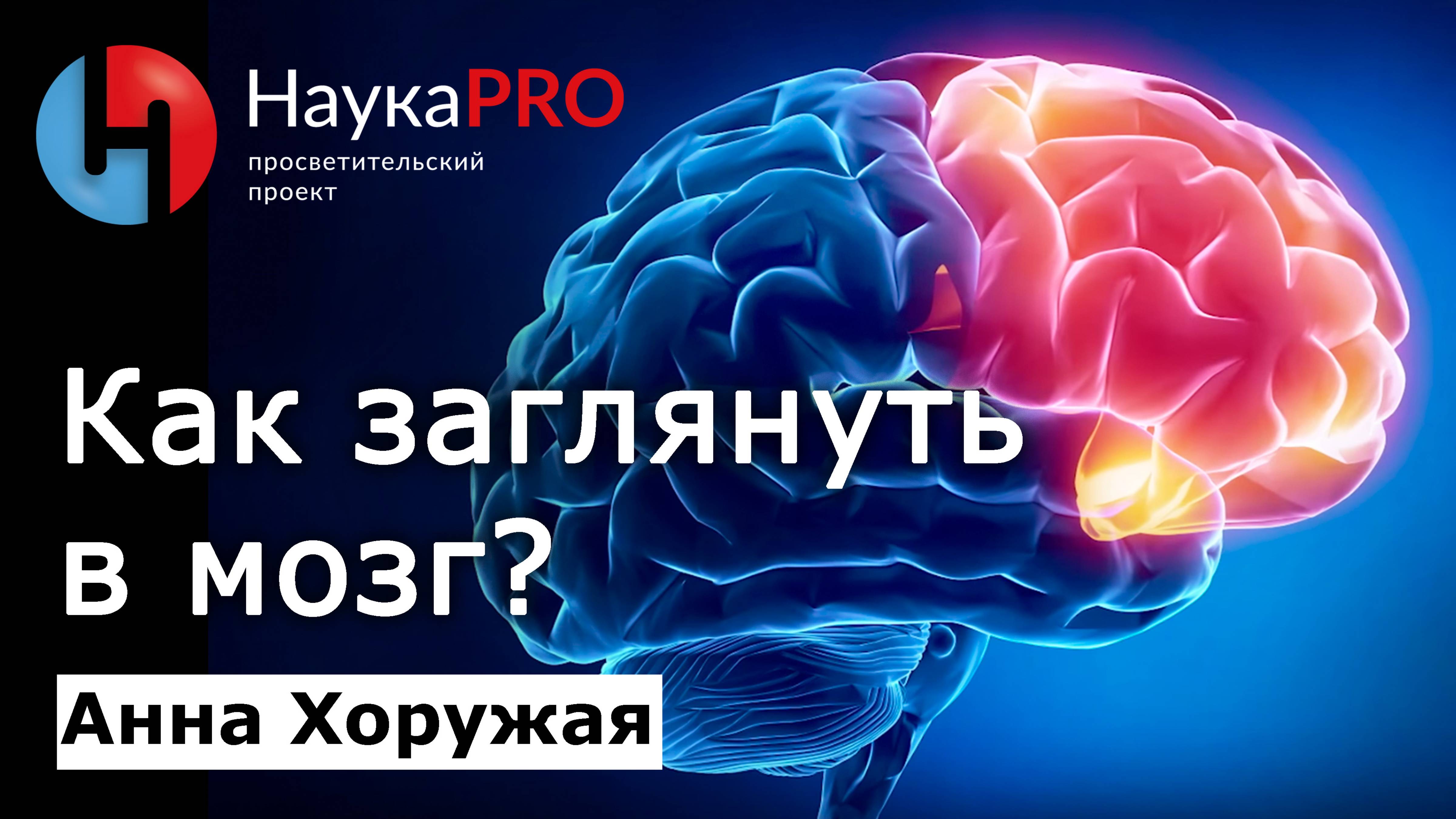 Как заглянуть в мозг человека? – Анна Хоружая | Лекции по медицине | Научпоп | Томография