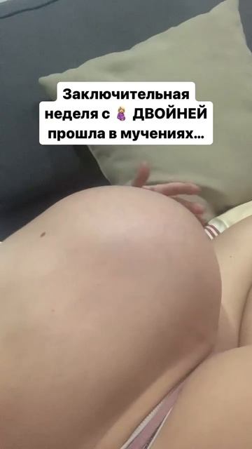 История родов ДВОЙНИ
Часть 2