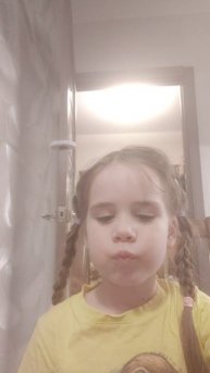 У меня выпал зуб! первый молочный зуб выпал