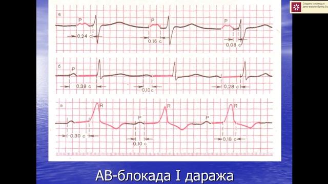 Юрак камаллари