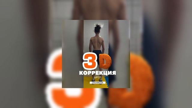 Трехмерная коррекция сколиоза
